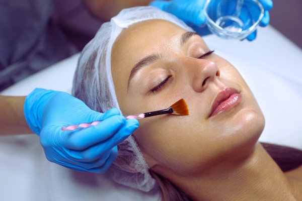 ✨ Chemical Peel